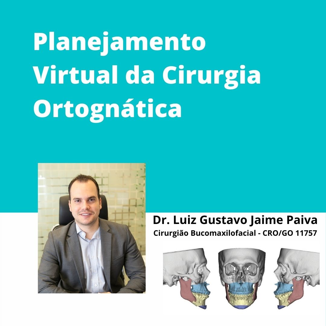 planejamento-virtual-cirurgia-ortognática