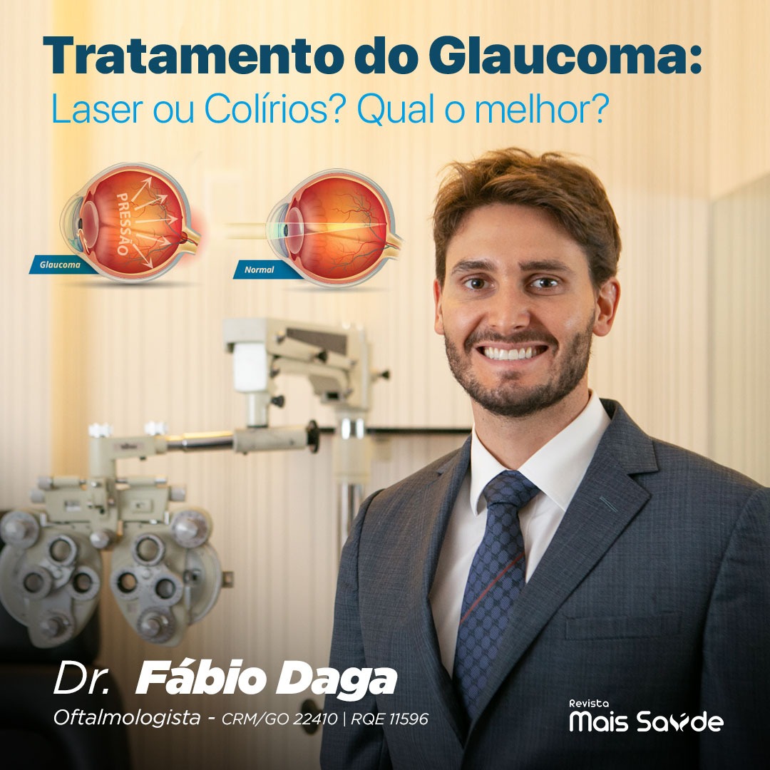 tratamento-glaucoma-laser-colirio