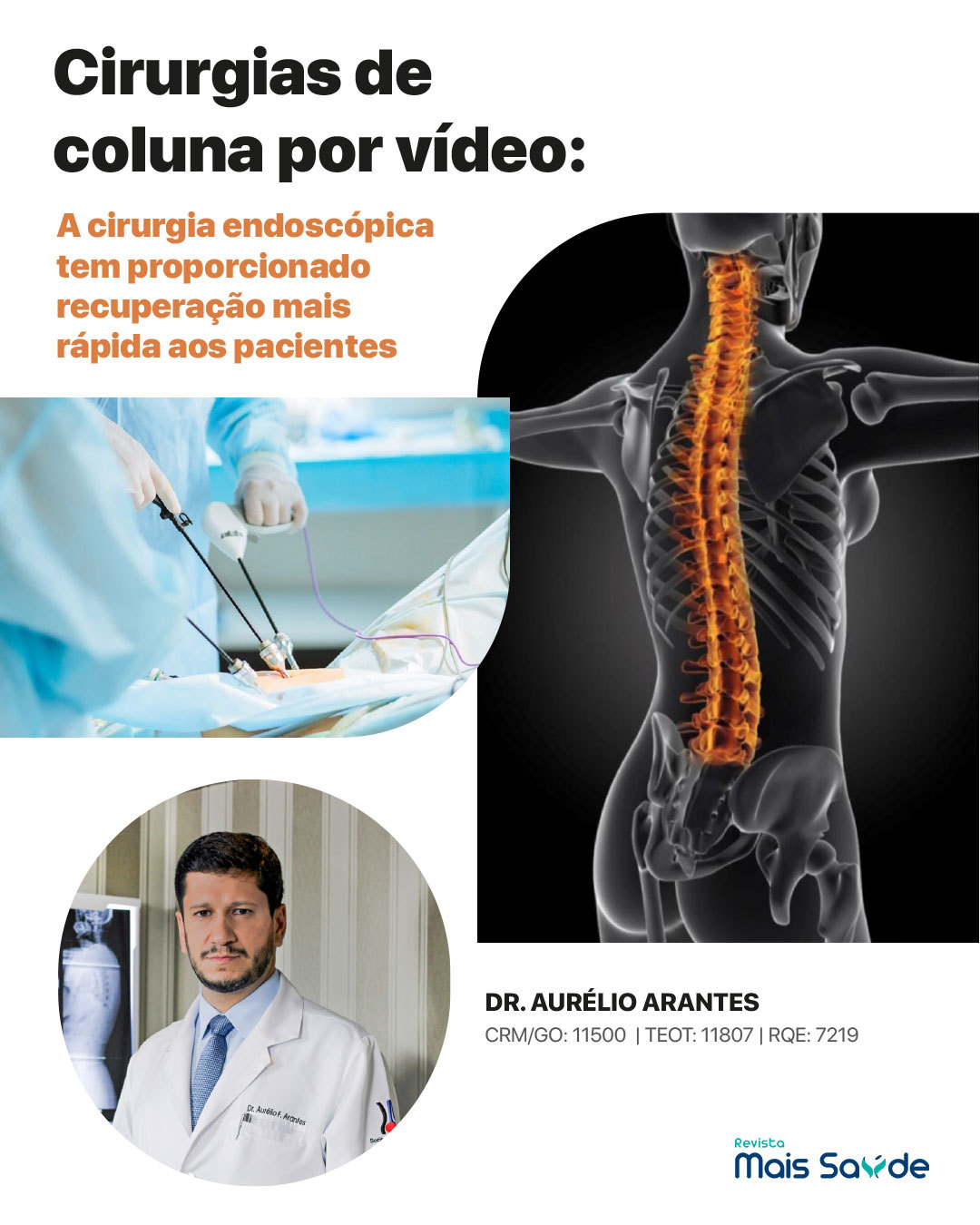 cirurgia-coluna-video