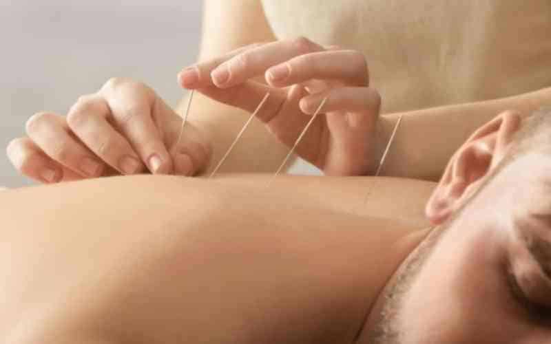 acupuntura-tratamento-dor