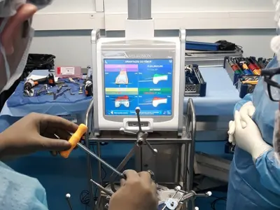 Cirurgia robótica de artroplastia realizada pelo Dr. Ulbiramar Correia