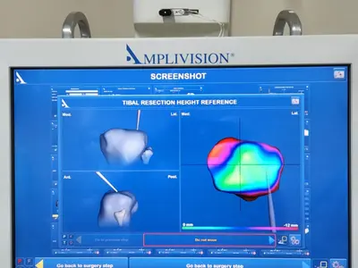 Técnica cirúrgica com amplivision