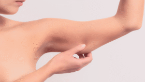 melhor-tratamento-flacidez-facial-corporal-goiania