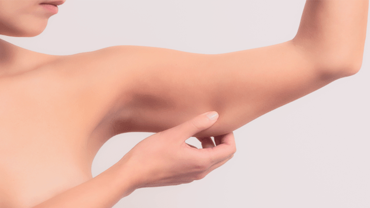melhor-tratamento-flacidez-facial-corporal-goiania