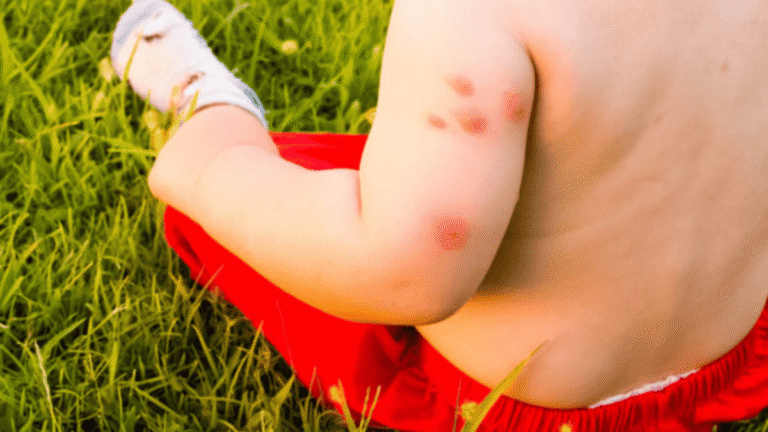 mosquitos-insetos-dra-larissa-trivelato